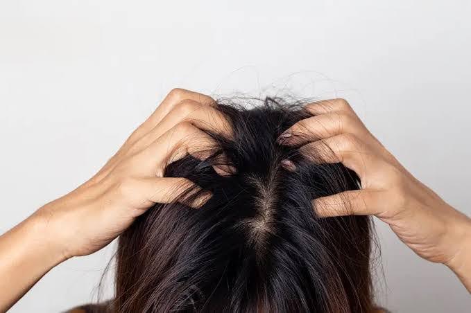لماذا تصاب المرأة بـ قمل الرأس؟ وكيف تتخلص منه!